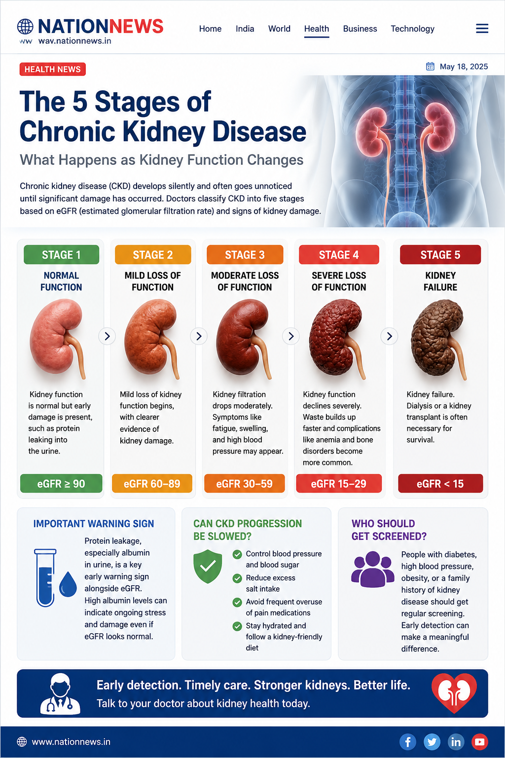 Silent Kidney Damage Often Goes Unnoticed Until It’s Too Late: Doctors Explain the 5 Stages of Chronic Kidney Disease